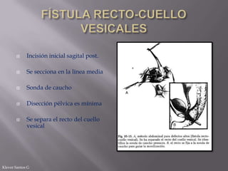 

Incisión inicial sagital post.



Se secciona en la línea media



Sonda de caucho



Disección pélvica es mínima



Se separa el recto del cuello
vesical

Klever Santos G

 