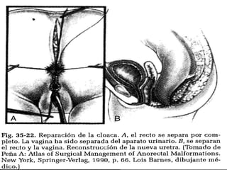 malformaciones anorrectales