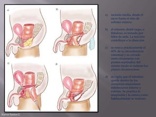 a)

incisión media, desde el
sacro hasta el sitio de
esfínter externo

b)

el extremo distal ciego, o
fistuloso, es tomado por
hilos de seda. La tracción
contribuye a la disección

c)

se reseca prácticamente el
60% de la circunferencia
intestinal y es cerrado
meticulosamente con
puntos separados; del
mismo modo se suturan los
planos circunvecinos

d) se vigila que el intestino
quede dentro de los
complejos musculares
esfinterianos interno y
externo. Se practica la
anoplastia y la sutura como
habitualmente se realizan.

Klever Santos G

 