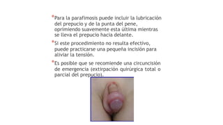 *Para la parafimosis puede incluir la lubricación
del prepucio y de la punta del pene,
oprimiendo suavemente esta última mientras
se lleva el prepucio hacia delante.
*Si este procedimiento no resulta efectivo,
puede practicarse una pequeña incisión para
aliviar la tensión.
*Es posible que se recomiende una circuncisión
de emergencia (extirpación quirúrgica total o
parcial del prepucio).
 