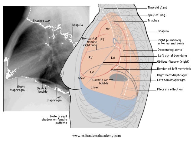 Chest x ray reading /certified fixed orthodontic courses by Indian de…
