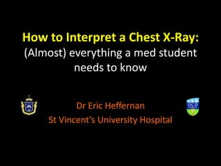 How to Interpret a Chest X-Ray:
(Almost) everything a med student
needs to know
Dr Eric Heffernan
St Vincent’s University Hospital
 