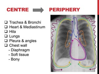 CENTRE PERIPHERY
 Trachea & Bronchi
 Heart & Mediastinum
 Hila
 Lungs
 Pleura & angles
 Chest wall
- Diaphragm
- Soft tissue
- Bony
 