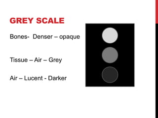 GREY SCALE
Bones- Denser – opaque
Tissue – Air – Grey
Air – Lucent - Darker
 