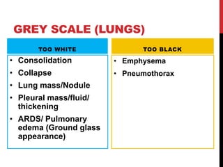GREY SCALE (LUNGS)
TOO WHITE
• Consolidation
• Collapse
• Lung mass/Nodule
• Pleural mass/fluid/
thickening
• ARDS/ Pulmonary
edema (Ground glass
appearance)
TOO BLACK
• Emphysema
• Pneumothorax
 