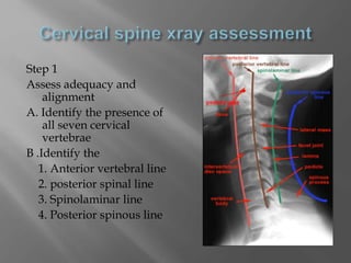 Step 1
Assess adequacy and
alignment
A. Identify the presence of
all seven cervical
vertebrae
B .Identify the
1. Anterior vertebral line
2. posterior spinal line
3. Spinolaminar line
4. Posterior spinous line
 