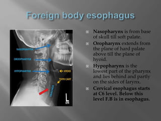  Nasopharynx is from base
of skull till soft palate.
 Oropharynx extends from
the plane of hard palate
above till the plane of
hyoid.
 Hypopharynx is the
lowest part of the pharynx
and lies behind and partly
on the sides of larynx.
 Cervical esophagus starts
at C6 level. Below this
level F.B is in esophagus.
 
