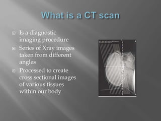  Is a diagnostic
imaging procedure
 Series of Xray images
taken from different
angles
 Processed to create
cross sectional images
of various tissues
within our body
 