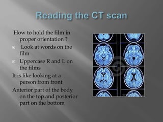 How to hold the film in
proper orientation ?
 Look at words on the
film
 Uppercase R and L on
the films
It is like looking at a
person from front
Anterior part of the body
on the top and posterior
part on the bottom
 