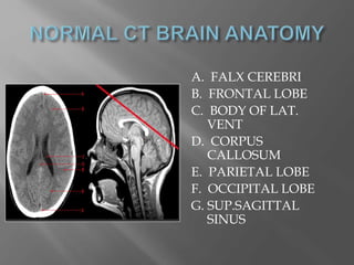 A. FALX CEREBRI
B. FRONTAL LOBE
C. BODY OF LAT.
VENT
D. CORPUS
CALLOSUM
E. PARIETAL LOBE
F. OCCIPITAL LOBE
G. SUP.SAGITTAL
SINUS
 