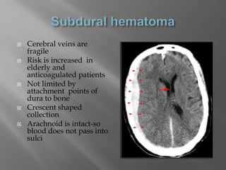  Cerebral veins are
fragile
 Risk is increased in
elderly and
anticoagulated patients
 Not limited by
attachment points of
dura to bone
 Crescent shaped
collection
 Arachnoid is intact-so
blood does not pass into
sulci
 