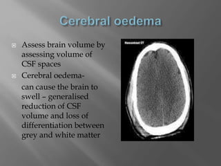  Assess brain volume by
assessing volume of
CSF spaces
 Cerebral oedema-
can cause the brain to
swell – generalised
reduction of CSF
volume and loss of
differentiation between
grey and white matter
 