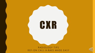 CXR
R A D I O LO G Y T I P S
R E F - O N C A L L X R AY S M A D E E A S YRadiology Tips
 