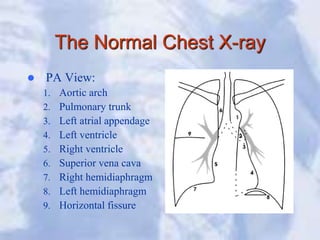 The Normal Chest X-ray
 PA View:
1. Aortic arch
2. Pulmonary trunk
3. Left atrial appendage
4. Left ventricle
5. Right ventricle
6. Superior vena cava
7. Right hemidiaphragm
8. Left hemidiaphragm
9. Horizontal fissure
 