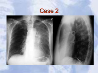 Case 2
 