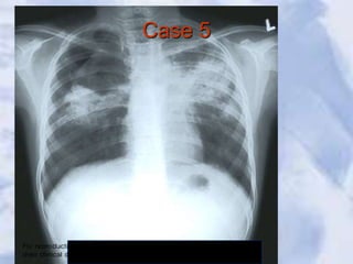 Case 5
 