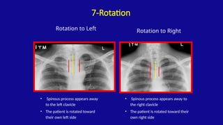 Chest xray - overview on mechanism of xray.pptx
