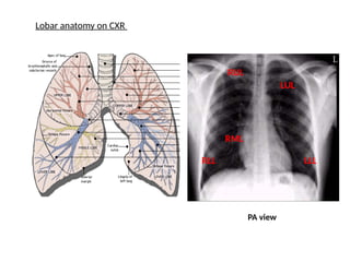 Chest X-ray in various respiratory conditions | PPTX
