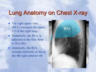 Chest x-ray booklet for medical school.pdf