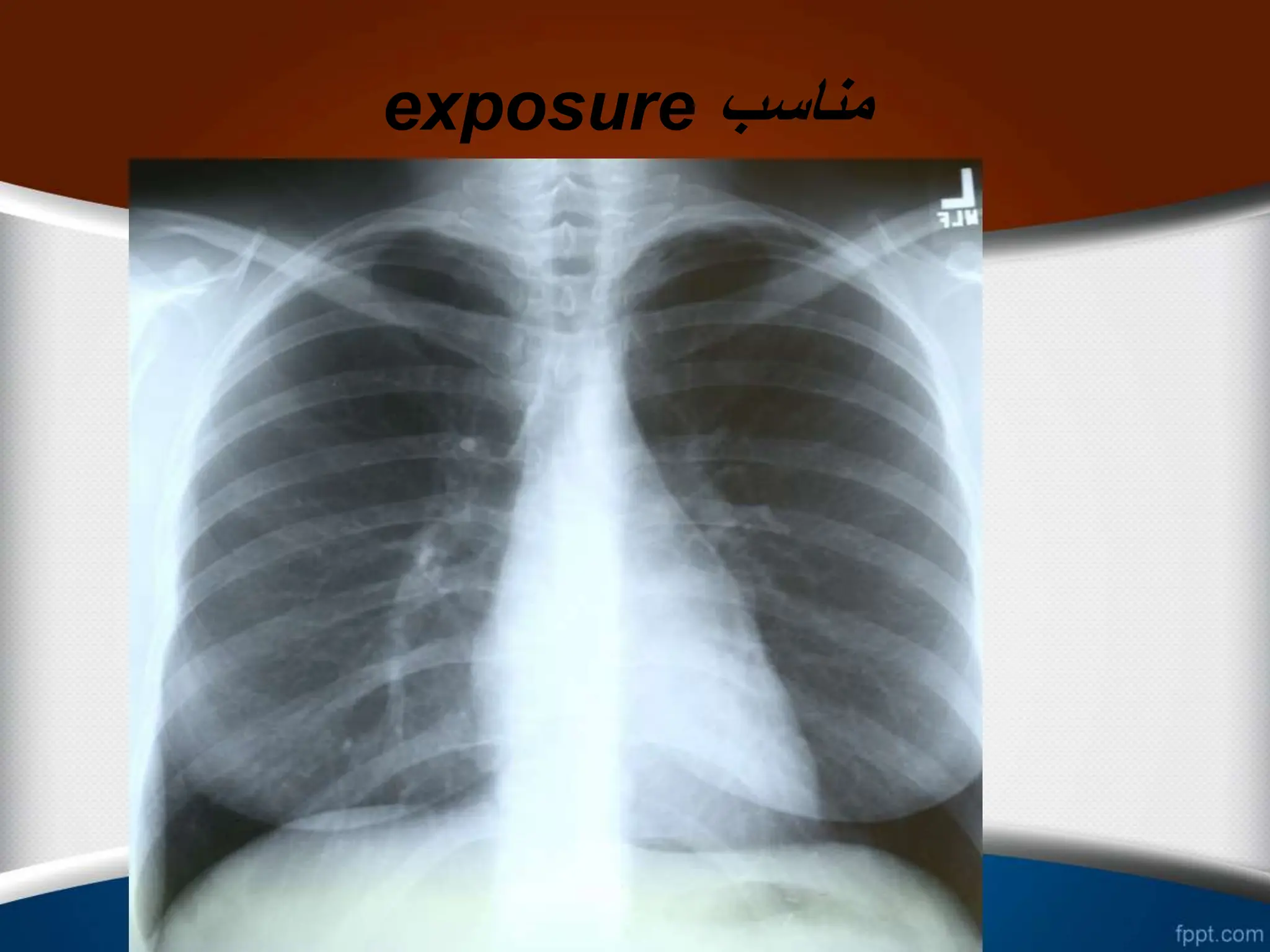 exposure ‫مناسب‬
 