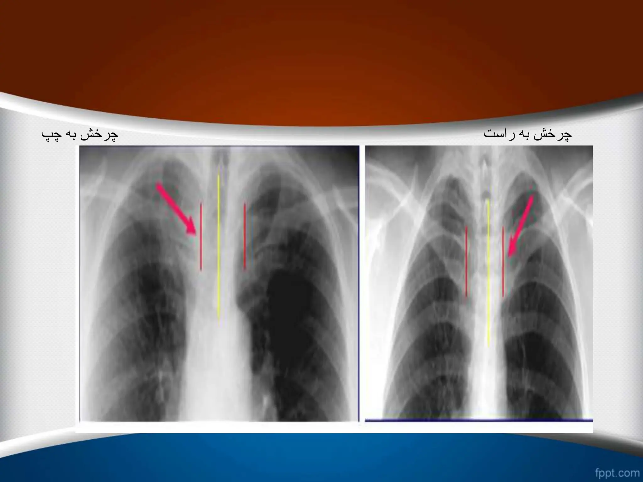 ‫چپ‬ ‫به‬ ‫چرخش‬ ‫راست‬ ‫به‬ ‫چرخش‬
 