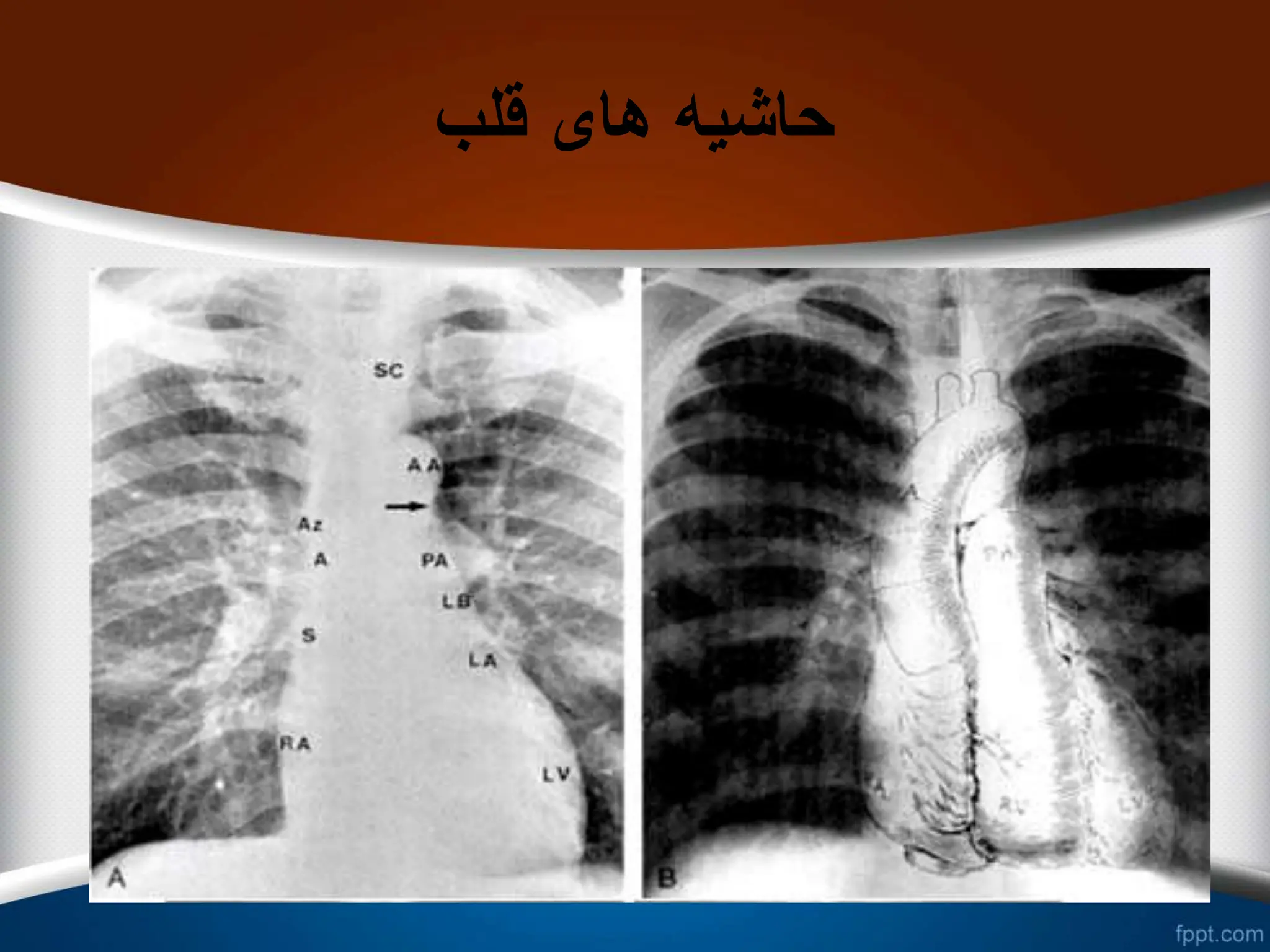 ‫قلب‬ ‫های‬ ‫حاشیه‬
 