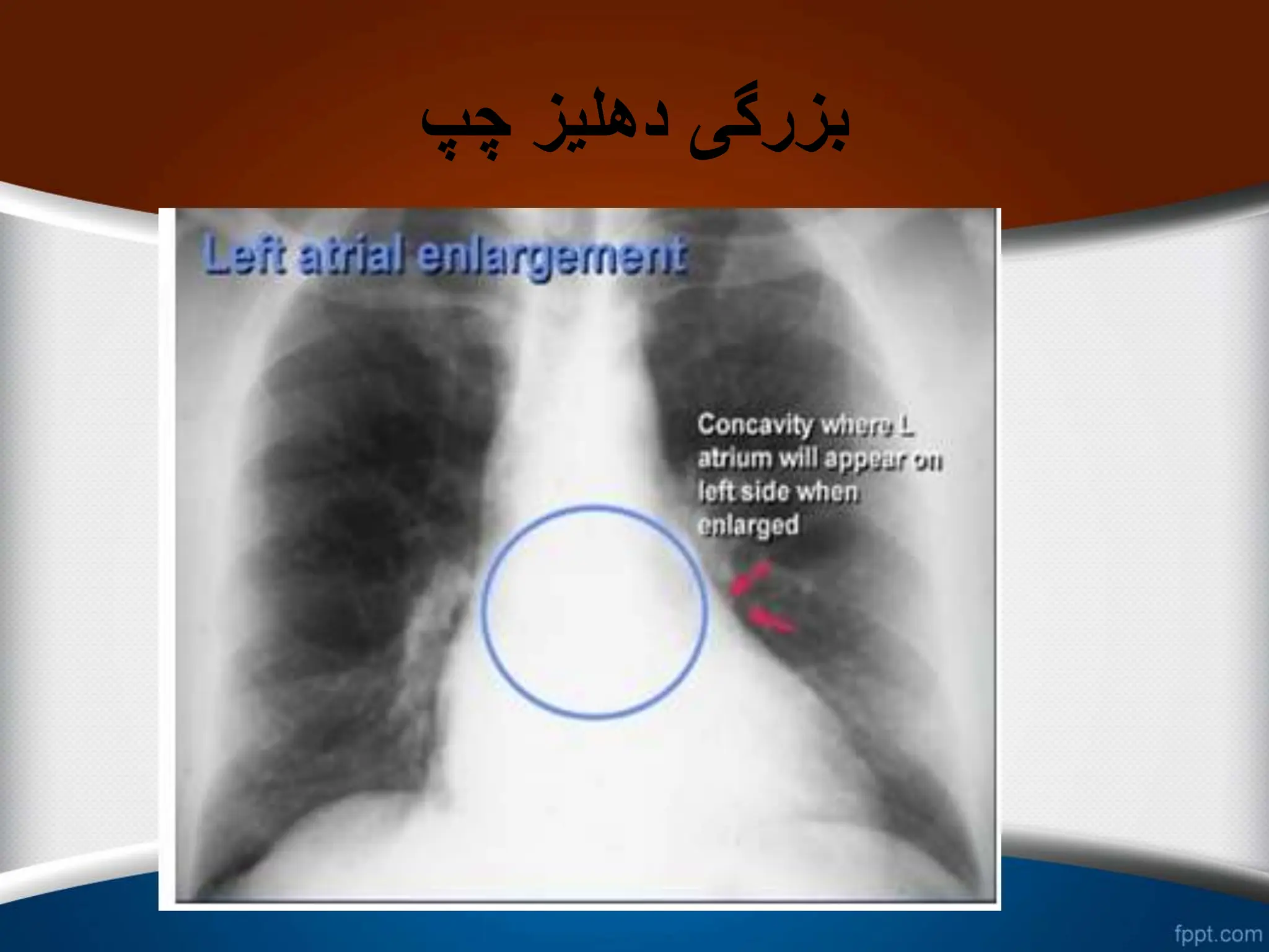 ‫چپ‬ ‫دهلیز‬ ‫بزرگی‬
 