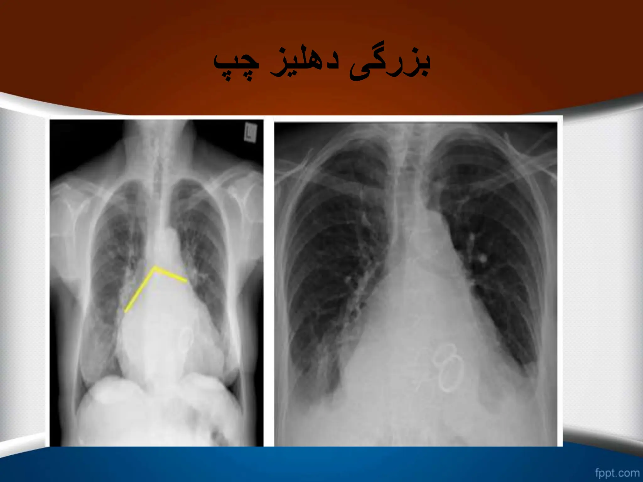 ‫چپ‬ ‫دهلیز‬ ‫بزرگی‬
 