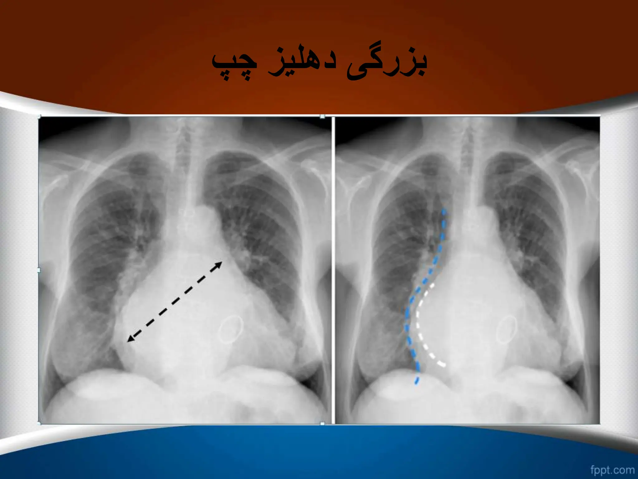 ‫چپ‬ ‫دهلیز‬ ‫بزرگی‬
 