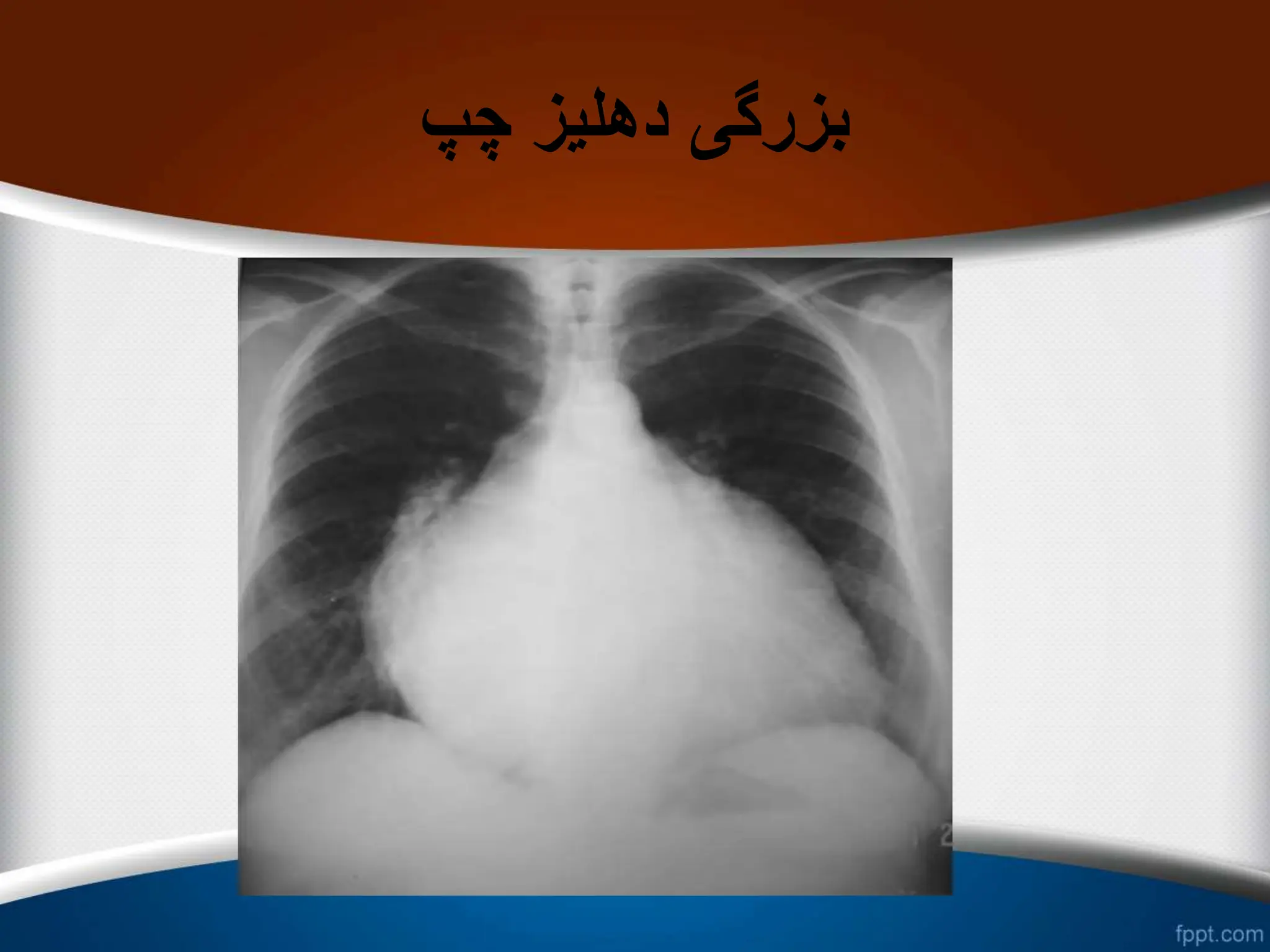 ‫چپ‬ ‫دهلیز‬ ‫بزرگی‬
 