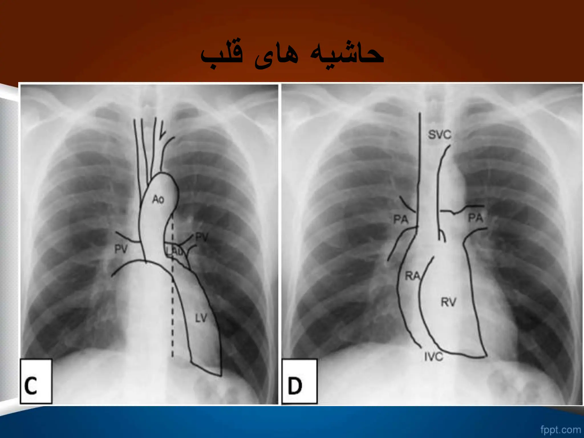 ‫قلب‬ ‫های‬ ‫حاشیه‬
 