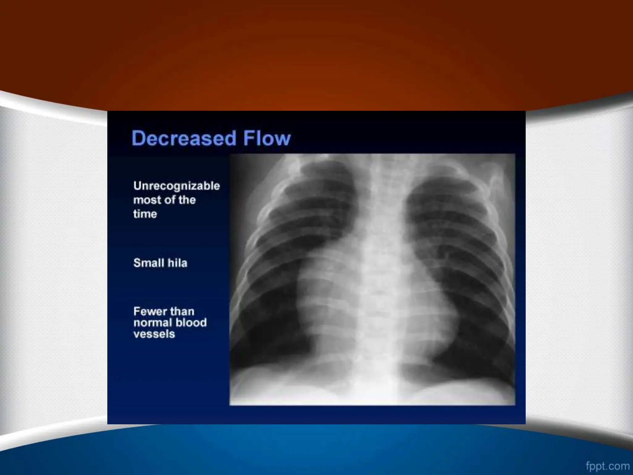 CXR - new.ppt
