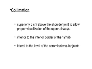 Comprehensive Guide to Chest X-Ray PA View Positioning and ...