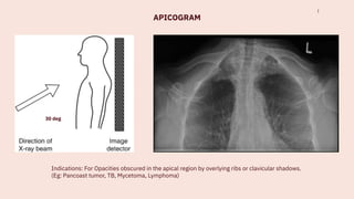 Comprehensive Guide to Chest X-Ray Techniques, Positioning, and ...