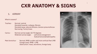 Comprehensive Guide to Chest X-Ray Techniques, Positioning, and ...