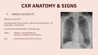 Comprehensive Guide to Chest X-Ray Techniques, Positioning, and ...