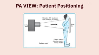 Comprehensive Guide to Chest X-Ray Techniques, Positioning, and ...