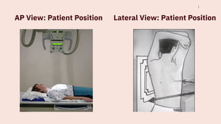 Comprehensive Guide to Chest X-Ray Techniques, Positioning, and ...