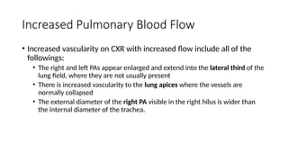 CXR approach to cardiac disease (1).pptx