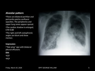 Comprehensive Chest X-Ray Pattern Recognition in Pulmonary Diseases | PPT