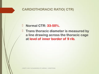 Cxr congenital | PPT