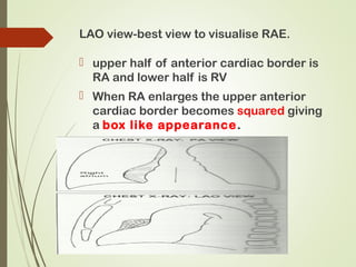 Cxr congenital | PPT