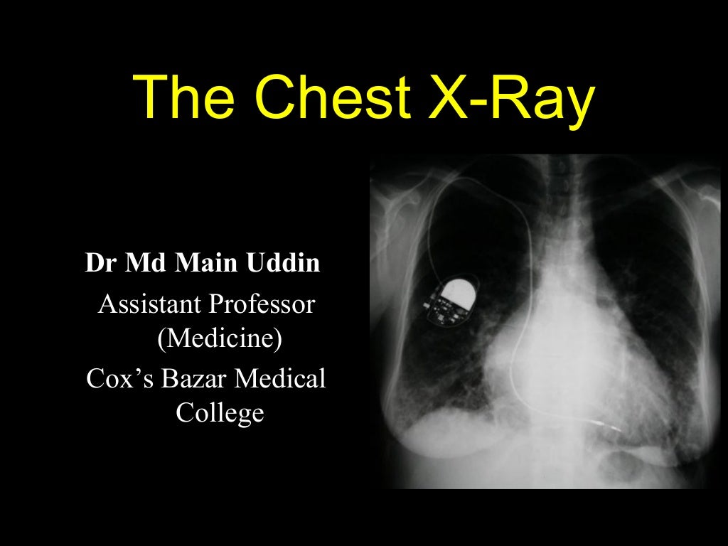 Interpretation of Chest XRay PPT