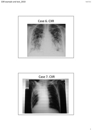 CXR example and test_2010                 19/07/53




                            Case 6. CXR




                            Case 7. CXR




                                                4
 