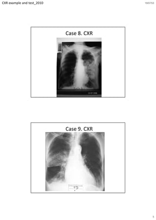 CXR example and test_2010                 19/07/53




                            Case 8. CXR




                            Case 9. CXR




                                                5
 