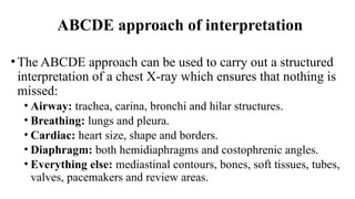 Chest X-Ray (CXR) Interpretation Made Easy: A Comprehensive Guide to ...