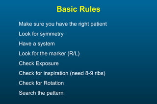 Basic Rules Make sure you have the right patient Look for symmetry  Have a system  Look for the marker (R/L) Check Exposure  Check for inspiration (need 8-9 ribs) Check for Rotation  Search the pattern 