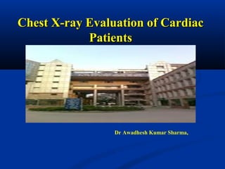 Chest X-ray Evaluation of Cardiac
            Patients




                 Dr Awadhesh Kumar Sharma,
 