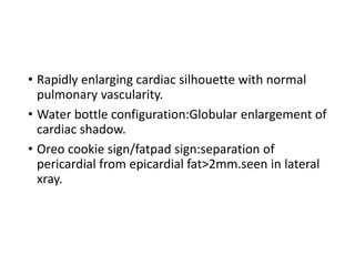 Cxr of common heart pathology agp | PPTX
