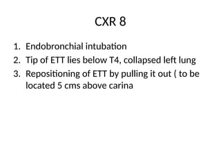 CXR OSCE.pptx in examination point of view | PPTX